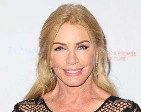 Shannon Tweed has not confirmed any plastic surgery rumors.